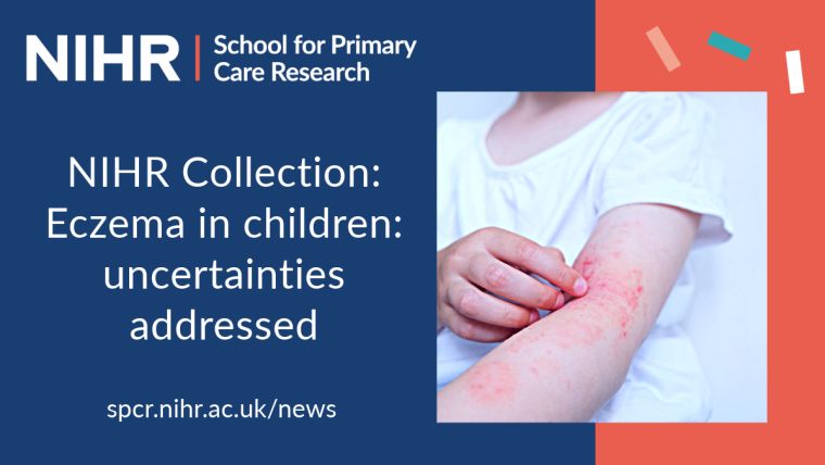 NIHR Collection: Eczema in children: uncertainties addressed